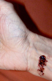 Stigmata